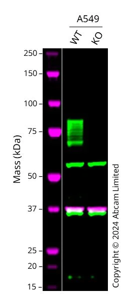 Western blot - Anti-TGF beta Receptor II antibody [EPR24349-124] - BSA and Azide free (AB283230)