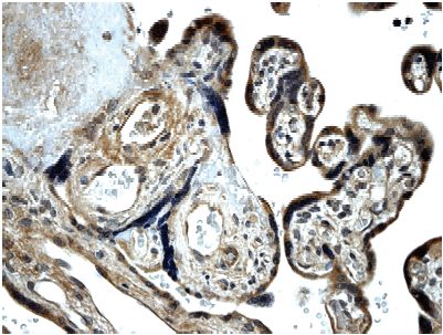 Immunohistochemistry (Formalin/PFA-fixed paraffin-embedded sections) - Anti-TGF beta Receptor II antibody [MM0056-4F14] - BSA and Azide free (AB78419)