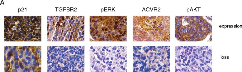 Immunohistochemistry - Anti-TGF beta Receptor II antibody [MM0056-4F14] - BSA and Azide free (AB78419)