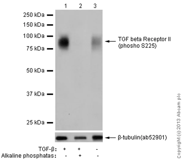 Western blot - Anti-TGF beta Receptor II (phospho S225) antibody [EPR12198] (AB183037)