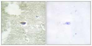 Immunohistochemistry (Formalin/PFA-fixed paraffin-embedded sections) - Anti-TGF beta Receptor II (phospho S225 + S250) antibody (AB111564)