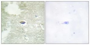 Immunohistochemistry (Formalin/PFA-fixed paraffin-embedded sections) - Anti-TGF beta Receptor II (phospho S225 + S250) antibody (AB111564)