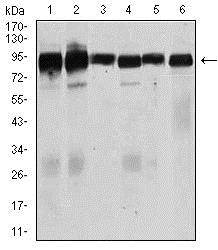 Western blot - Anti-TGF beta Receptor III/TGFBR3 antibody [1C5H11] (AB166705), expandable thumbnail