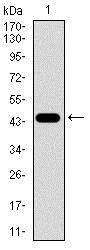 Western blot - Anti-TGF beta Receptor III/TGFBR3 antibody [1C5H11] (AB166705), expandable thumbnail