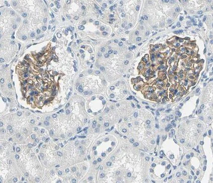 Immunohistochemistry (Formalin/PFA-fixed paraffin-embedded sections) - Anti-TGF beta Receptor III/TGFBR3 antibody (AB224075)