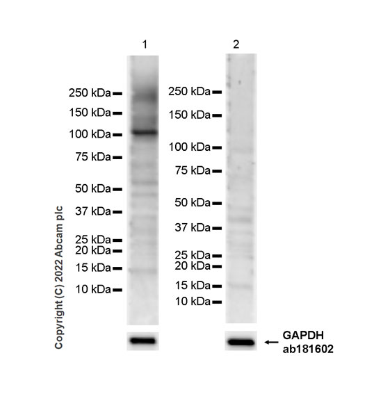 Western blot - Anti-TGF beta Receptor III/TGFBR3 antibody [EPR26190-43] - BSA and Azide free (AB307703)