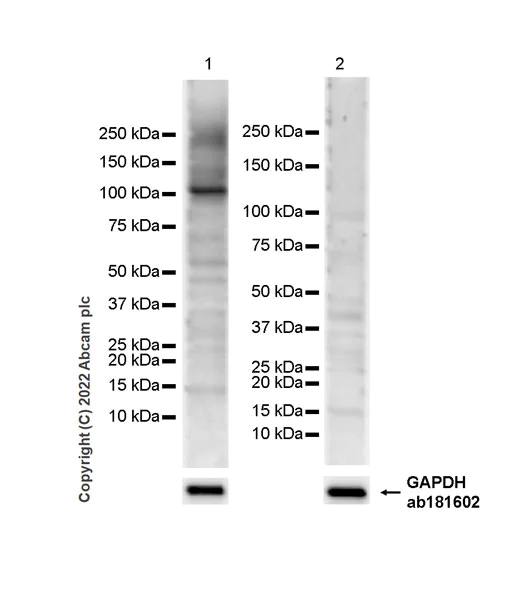 Western blot - Anti-TGF beta Receptor III/TGFBR3 antibody [EPR26190-43] - BSA and Azide free (AB307703)