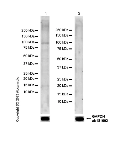 Western blot - Anti-TGF beta Receptor III/TGFBR3 antibody [EPR26190-43] - BSA and Azide free (AB307703)