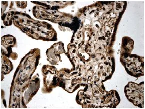 Immunohistochemistry (Formalin/PFA-fixed paraffin-embedded sections) - Anti-TGF beta Receptor III/TGFBR3 antibody [MM0057-5G9] (AB78421)
