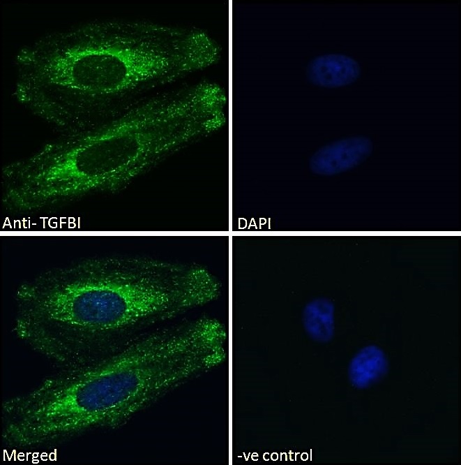 Immunocytochemistry/ Immunofluorescence - Anti-TGFBI antibody (AB99562), expandable thumbnail