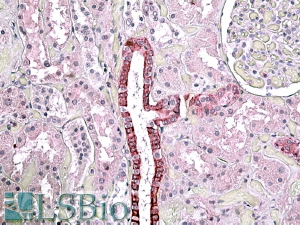 Immunohistochemistry (Formalin/PFA-fixed paraffin-embedded sections) - Anti-TGFBI antibody (AB99562), expandable thumbnail