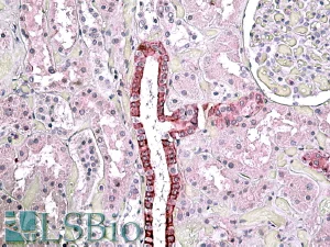 Immunohistochemistry (Formalin/PFA-fixed paraffin-embedded sections) - Anti-TGFBI antibody (AB99562)