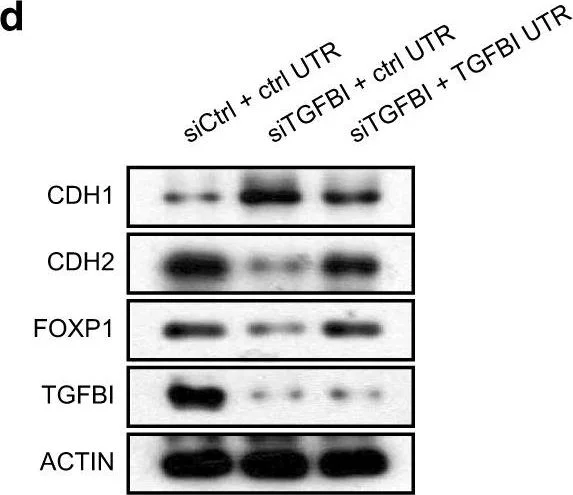 Western blot - Anti-TGFBI antibody [EPR12078(B)] (AB170874)