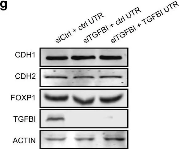 Western blot - Anti-TGFBI antibody [EPR12078(B)] (AB170874)