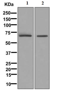 Western blot - Anti-TGFBI antibody [EPR12078(B)] (AB170874), expandable thumbnail