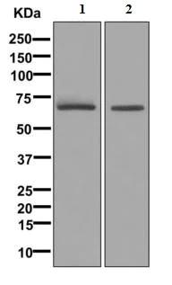 Western blot - Anti-TGFBI antibody [EPR12078(B)] (AB170874)