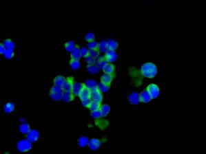 Immunocytochemistry/ Immunofluorescence - Anti-TGFBI antibody [EPR12078(B)] - BSA and Azide free (AB240162), expandable thumbnail