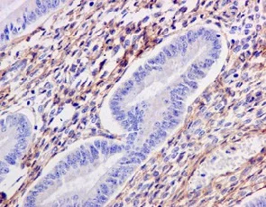 Immunohistochemistry (Formalin/PFA-fixed paraffin-embedded sections) - Anti-TGFBI antibody [EPR12078(B)] - BSA and Azide free (AB240162)