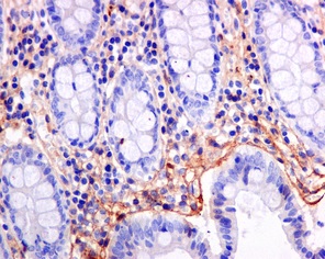 Immunohistochemistry (Formalin/PFA-fixed paraffin-embedded sections) - Anti-TGFBI antibody [EPR12078(B)] - BSA and Azide free (AB240162), expandable thumbnail