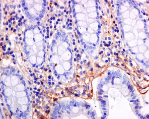 Immunohistochemistry (Formalin/PFA-fixed paraffin-embedded sections) - Anti-TGFBI antibody [EPR12078(B)] - BSA and Azide free (AB240162)
