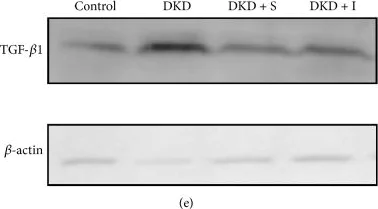 Western blot - Anti-TGFBI antibody [EPR12079(B)] (AB169771)