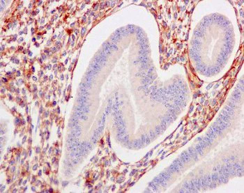 Immunohistochemistry (Formalin/PFA-fixed paraffin-embedded sections) - Anti-TGFBI antibody [EPR12079(B)] - BSA and Azide free (AB249517)