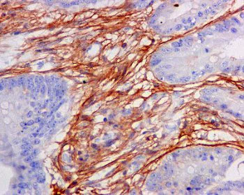 Immunohistochemistry (Formalin/PFA-fixed paraffin-embedded sections) - Anti-TGFBI antibody [EPR12079(B)] - BSA and Azide free (AB249517)
