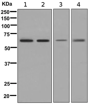 Western blot - Anti-TGFBI antibody [EPR12079(B)] - BSA and Azide free (AB249517)