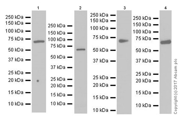 Western blot - Anti-TGFBI antibody [EPR17990-13] (AB187085), expandable thumbnail