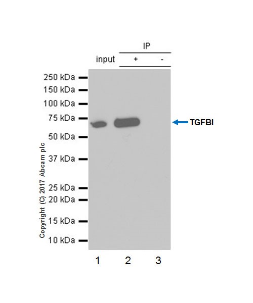 Immunoprecipitation - Anti-TGFBI antibody [EPR17990-13] - BSA and Azide free (AB228133)