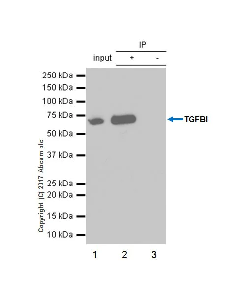 Immunoprecipitation - Anti-TGFBI antibody [EPR17990-13] - BSA and Azide free (AB228133)