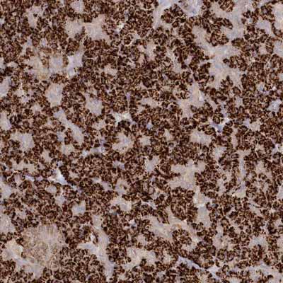 Immunohistochemistry (Formalin/PFA-fixed paraffin-embedded sections) - Anti-TGFBRAP1 antibody (AB122468)