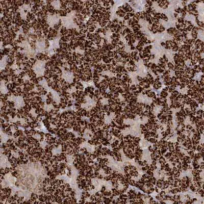 Immunohistochemistry (Formalin/PFA-fixed paraffin-embedded sections) - Anti-TGFBRAP1 antibody (AB122468)