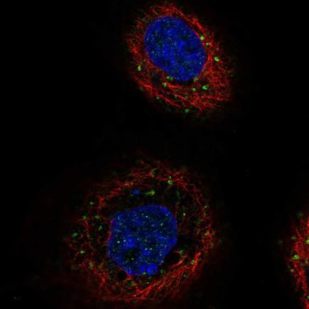 Immunocytochemistry/ Immunofluorescence - Anti-TGFBRAP1 antibody (AB220084), expandable thumbnail