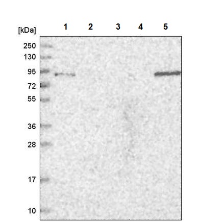 Western blot - Anti-TGFBRAP1 antibody (AB220084), expandable thumbnail