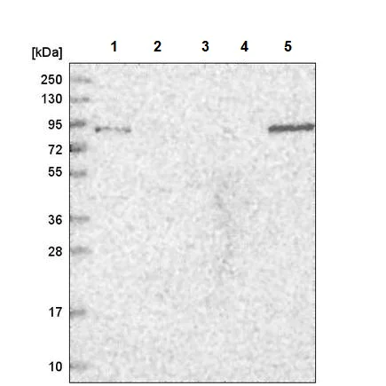Western blot - Anti-TGFBRAP1 antibody (AB220084)