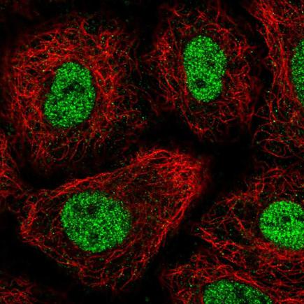 Immunocytochemistry/ Immunofluorescence - Anti-TGIF antibody (AB220965), expandable thumbnail