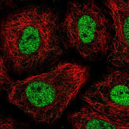 Immunocytochemistry/ Immunofluorescence - Anti-TGIF antibody (AB220965)