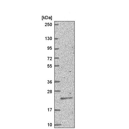 Western blot - Anti-TGIF antibody (AB220965), expandable thumbnail