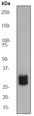 Western blot - Anti-TGIF antibody [EP637Y] (AB52955)