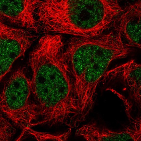 Immunocytochemistry/ Immunofluorescence - Anti-TGIF2 antibody (AB222131), expandable thumbnail