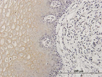 Immunohistochemistry (Formalin/PFA-fixed paraffin-embedded sections) - Anti-TGM1 antibody (AB167657)
