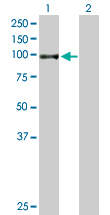 Western blot - Anti-TGM1 antibody (AB167657)