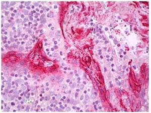 Immunohistochemistry (Formalin/PFA-fixed paraffin-embedded sections) - Anti-TGM1 antibody (AB183351)