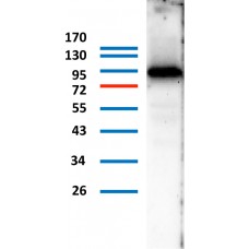 Western blot - Anti-TGM1 antibody (AB196339), expandable thumbnail