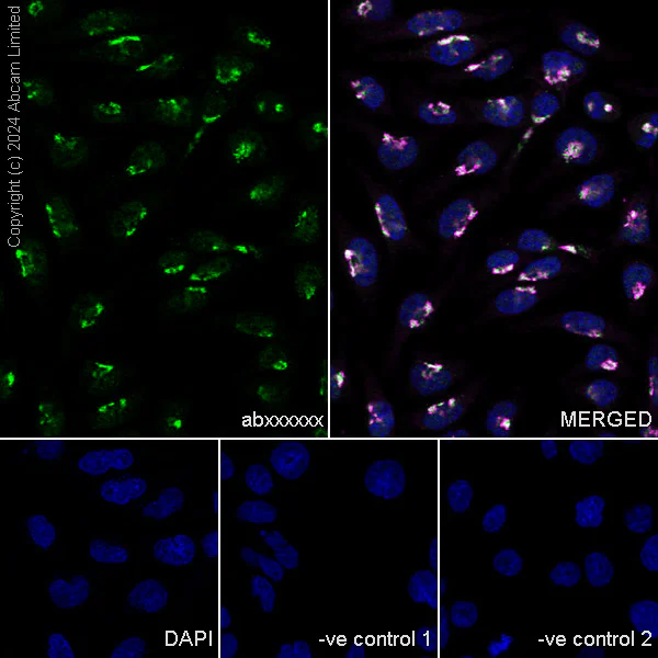 Immunocytochemistry/ Immunofluorescence - Anti-TGN38 antibody [EPR28143-541] - BSA and Azide free (AB321792)