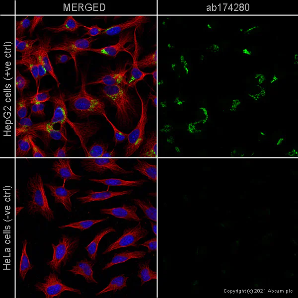 Immunocytochemistry/ Immunofluorescence - Anti-TGN46 antibody [EPR12676] - BSA and Azide free (AB249791)