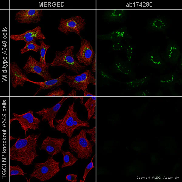 Immunocytochemistry/ Immunofluorescence - Anti-TGN46 antibody [EPR12676] - BSA and Azide free (AB249791)