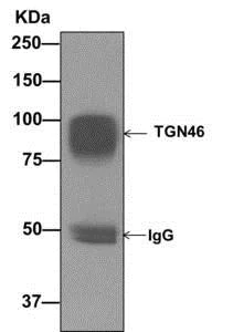 Immunoprecipitation - Anti-TGN46 antibody [EPR12676] - BSA and Azide free (AB249791)