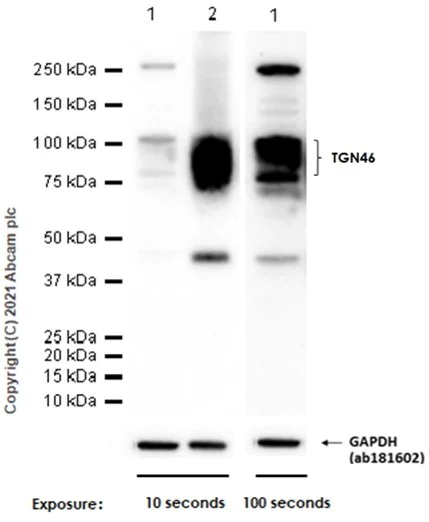 Western blot - Anti-TGN46 antibody [EPR12676] - BSA and Azide free (AB249791)